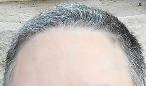 Buzz. February 2016. Not how it looks January 2017. © MKW I have a picture taken in June 2016 but I don't pass it around.